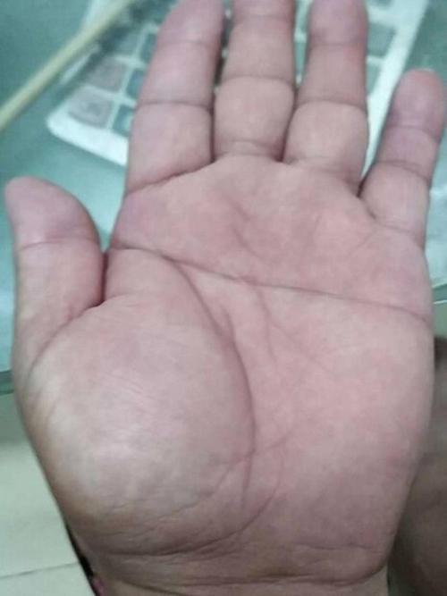 通贯掌有什么特征