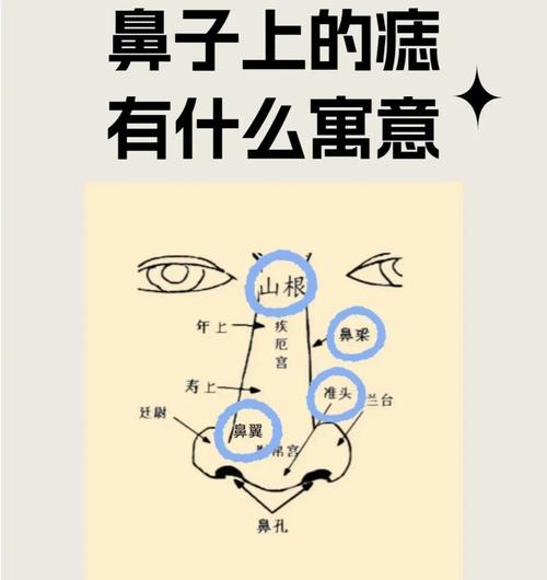 鼻子上长痣好不好 运势如何
