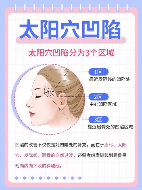 面相太阳穴凹陷好不好 太阳穴凹陷面相解析