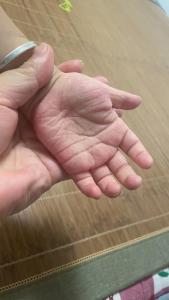 看掌纹知宝宝的身体状况