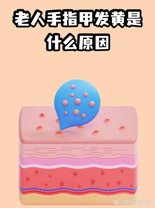 指甲颜色的变化预示着什么