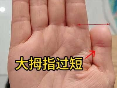 女人命苦的手相 大拇指短小易受欺负