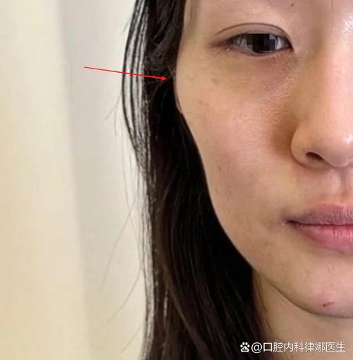女人颧骨突出面相如何：意志较为薄弱