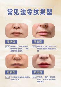 法令纹面相好吗