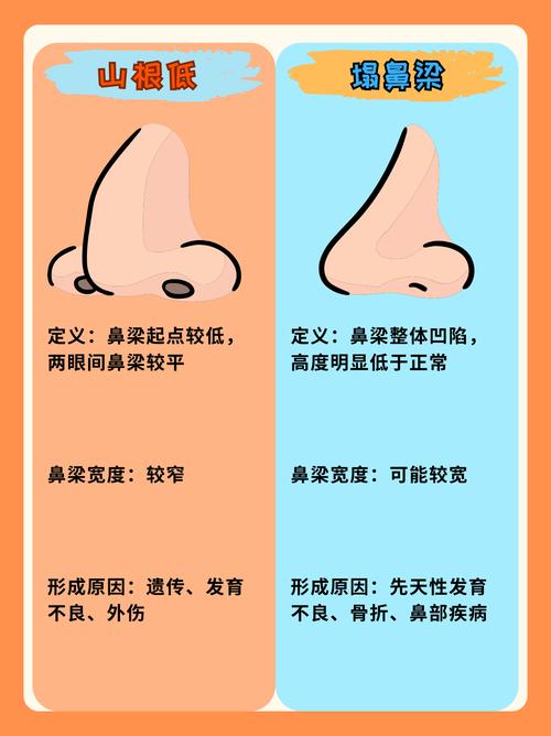 为什么南方人山根不宜高 北方人山根不宜低