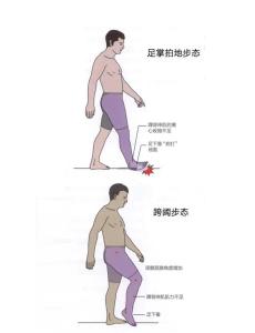 体相学中什么样的腿型感情容易受挫折