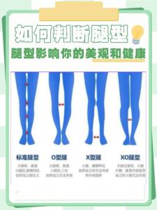 从一个人的腿型能预知健康情况吗