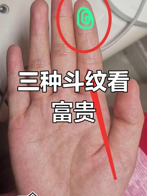女人六个斗形纹 运势极好但多愁善感