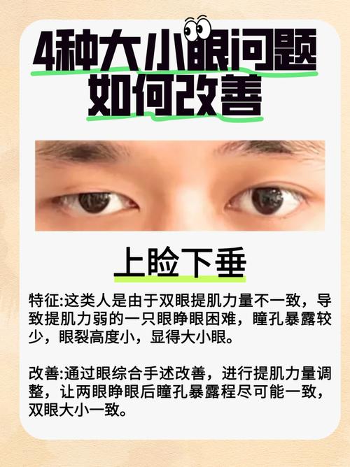 大小眼的面相好不好 大小眼面相解析