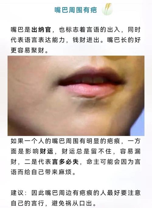 脸上有疤痕代表什么命运