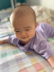 小孩有抬头纹说明什么？身体有问题吗