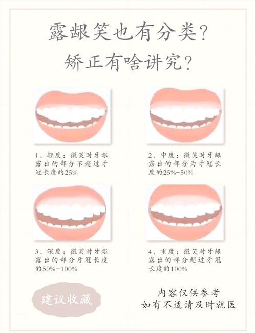 有露牙龈的人面相分析