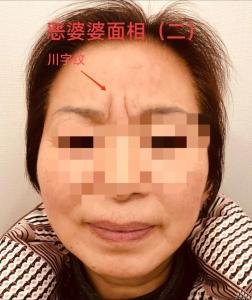 女人中年丧夫的面相特征